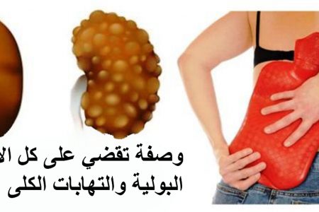 الالتهابات البولية:وصفة تقضي على كل الالتهابات البولية والتهابات الكلى بسرعة