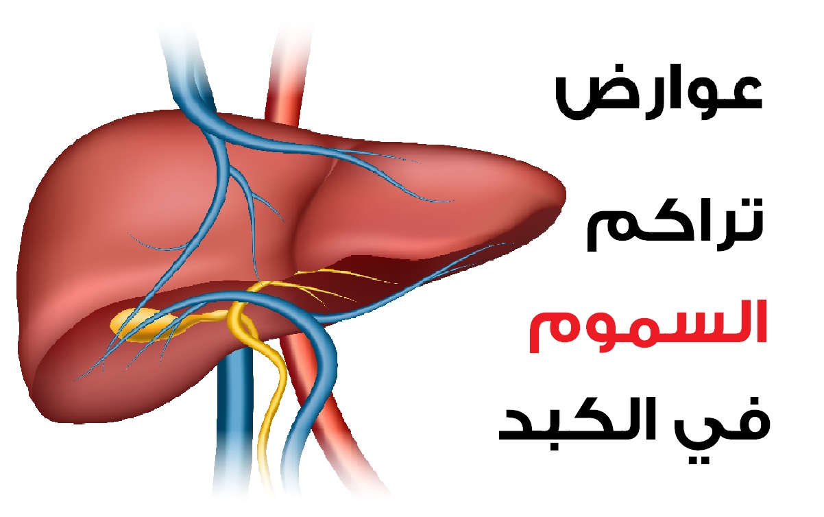 أصغوا إلى جسدكم واكتشفوا عوارض تراكم السموم في الكبد