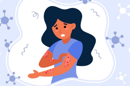 كيف تتخلصون من الصدفية عبر 9 وصفات طبيعية