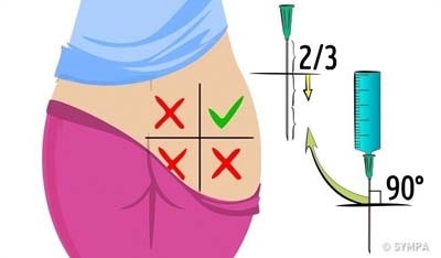3. كيفية القيام بالحقنة بالشكل الصحيح