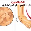 الكولاجين