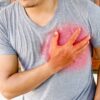 أعراض الذبحة الصدرية